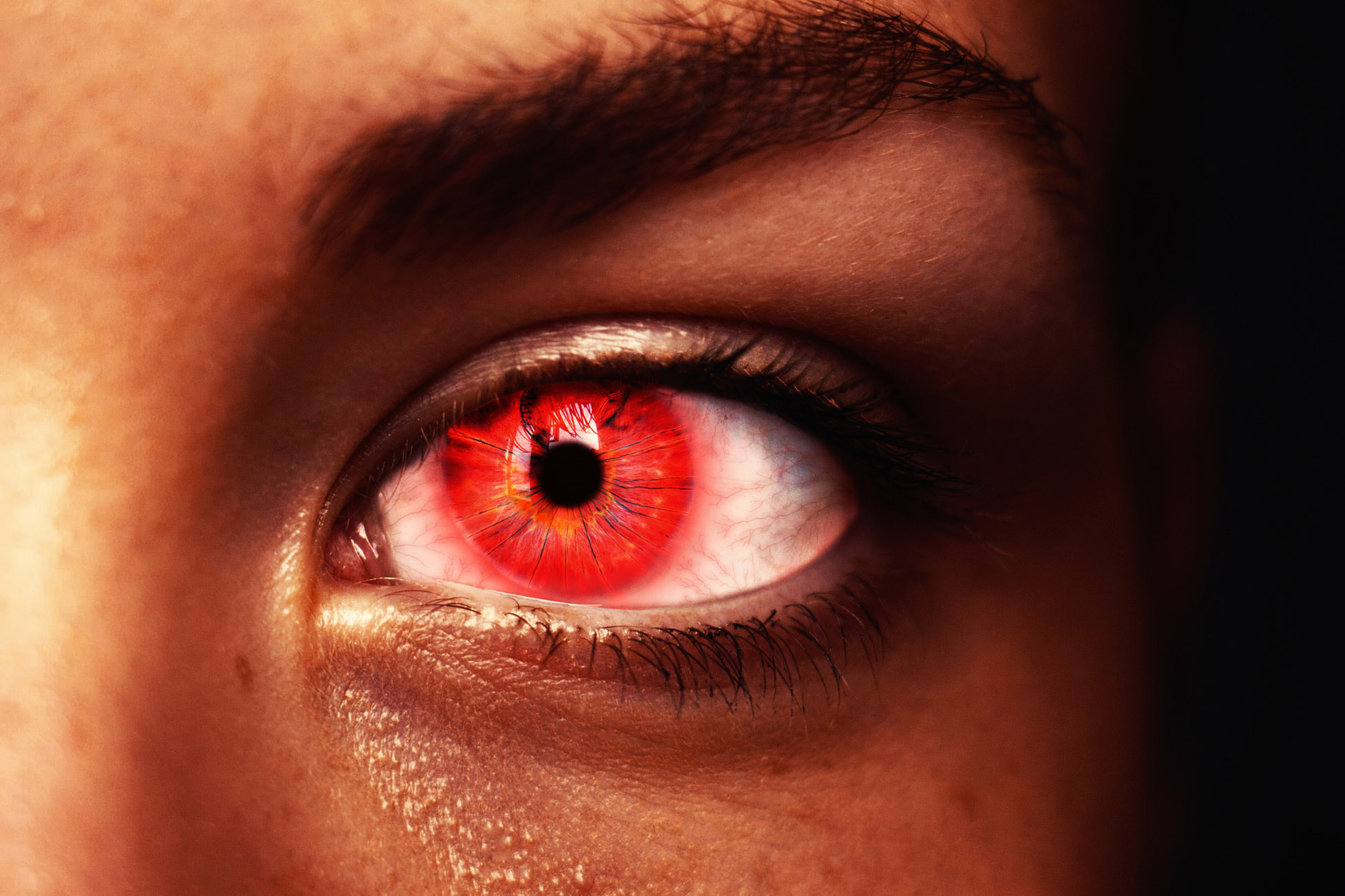 Red eye